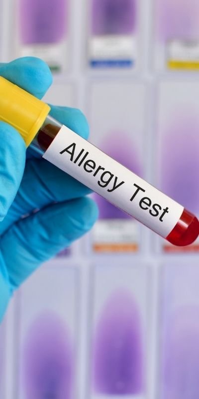 Allergy test near me